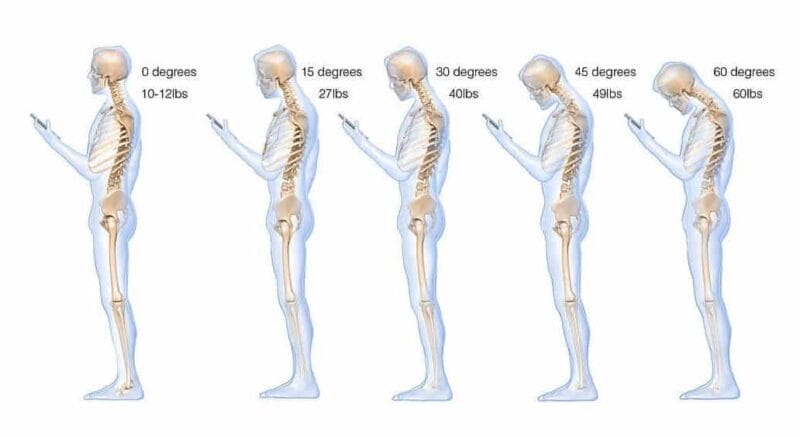 How Neck Posture affect your spine and neck muscle